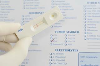 The error rate due to the implied decimal point used for prostate-specific antigen (PSA) results is substantially lower than previously noted. The error rate due to the implied decimal point used for prostate-specific antigen (PSA) results is substantially lower than previously noted.