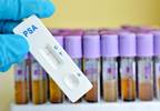 Despite USPSTF Recommendation, PSA Screening Sticking Around Despite USPSTF Recommendation, PSA Screening Sticking Around