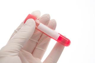Data suggest that most patients with MM taking immunomodulatory therapy are not receiving appropriate thromboprophylaxis. Data suggest that most patients with MM taking immunomodulatory therapy are not receiving appropriate thromboprophylaxis.