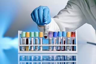 Researchers reviewed current research on maintenance therapy for multiple myeloma and provided recommendations for its application. Researchers reviewed current research on maintenance therapy for multiple myeloma and provided recommendations for its application.