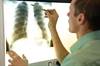 PD-L1 Inhibitor Approved by FDA for Non-Small Cell Lung Cancer PD-L1 Inhibitor Approved by FDA for Non-Small Cell Lung Cancer