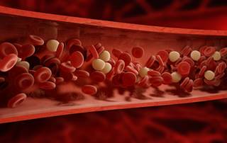 Eltrombopag was well-tolerated, significantly raised platelet counts, and reduced bleeding events among patients with MDS and severe thrombocytopenia. Eltrombopag was well-tolerated, significantly raised platelet counts, and reduced bleeding events among patients with MDS and severe thrombocytopenia.