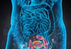 Non-Invasive Test for Urothelial Cancer Detection Non-Invasive Test for Urothelial Cancer Detection
