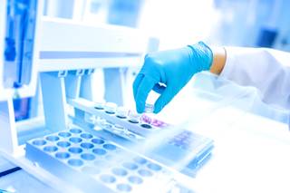 Study results suggest that <sup>99m</sup>Tc-MIBI SPECT/CT use can improve the differentiation between benign and malignant kidney tumors. Study results suggest that <sup>99m</sup>Tc-MIBI SPECT/CT use can improve the differentiation between benign and malignant kidney tumors.