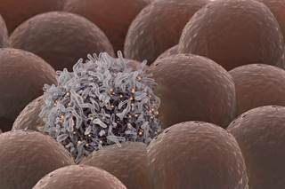 Dabrafenib plus trametinib is the first adjuvant therapy indicated specifically for melanoma with the BRAFV600 mutation. Dabrafenib plus trametinib is the first adjuvant therapy indicated specifically for melanoma with the BRAFV600 mutation.