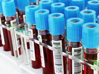 Study results support development of therapeutics that are targeted and based on individual genetic variants and would generalize across patient-groups in AML. Study results support development of therapeutics that are targeted and based on individual genetic variants and would generalize across patient-groups in AML.