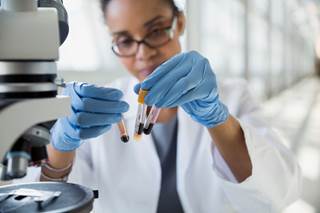 Researchers compared the safety and efficacy of ruxolitinib vs momelotinib, a selective JAK1/2 inhibitor, among JAK inhibitor–naïve patients with myelofibrosis. Researchers compared the safety and efficacy of ruxolitinib vs momelotinib, a selective JAK1/2 inhibitor, among JAK inhibitor–naïve patients with myelofibrosis.