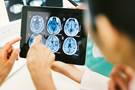 Immunotherapy in Glioblastoma: Peaks and Pits Immunotherapy in Glioblastoma: Peaks and Pits