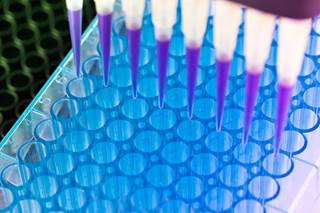 Cancer Therapy Advisor asked Dr Rabinowitz, founder and CEO of Natera, about the bespoke PCR technology and ongoing studies. Cancer Therapy Advisor asked Dr Rabinowitz, founder and CEO of Natera, about the bespoke PCR technology and ongoing studies.