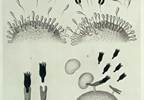 Monoclonal Antibodies as Immunotherapy "Magic Bullets" Monoclonal Antibodies as Immunotherapy "Magic Bullets"