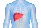 Immune-mediated Hepatitis: Challenges in Management Immune-mediated Hepatitis: Challenges in Management