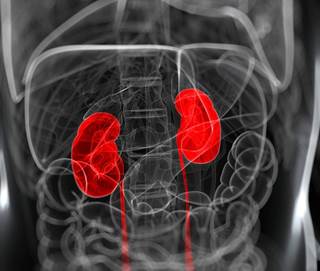 Patients in all subgroups who received adjuvant sunitinib had a DFS benefit compared with placebo, including patients who were at a higher risk of recurrence. Patients in all subgroups who received adjuvant sunitinib had a DFS benefit compared with placebo, including patients who were at a higher risk of recurrence.