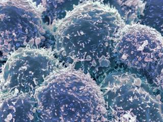 Assessments of MET copy number gain are not predictive of benefit from TKI therapy in EGFR-mutant NSCLC, according to researchers. Assessments of MET copy number gain are not predictive of benefit from TKI therapy in EGFR-mutant NSCLC, according to researchers.