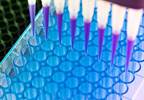 Liquid Biopsy Test Accurately Detects <i>RAS</i> Mutations in Metastatic Colorectal Cancer Liquid Biopsy Test Accurately Detects <i>RAS</i> Mutations in Metastatic Colorectal Cancer