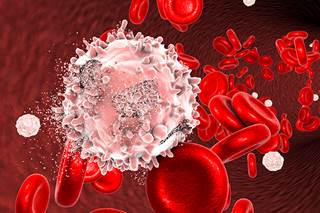 Patients with B-ALL may benefit from sequential treatment with CD19 CAR-T therapy and anti-CD19 bispecific T-cell engager therapy regardless of sequence, according to a case study report. Patients with B-ALL may benefit from sequential treatment with CD19 CAR-T therapy and anti-CD19 bispecific T-cell engager therapy regardless of sequence, according to a case study report.