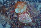 Cancer Drug Addiction: Prospects for Integrated Therapeutic Management Cancer Drug Addiction: Prospects for Integrated Therapeutic Management
