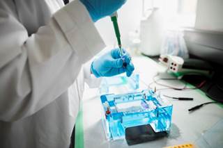 Disruptions of the p53 tumor suppressor pathway play a key role in tumorigenesis and tumor progression in solid and hematologic malignancies. Disruptions of the p53 tumor suppressor pathway play a key role in tumorigenesis and tumor progression in solid and hematologic malignancies.