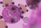 Managing Adverse Events in the Era of Immunotherapy Managing Adverse Events in the Era of Immunotherapy
