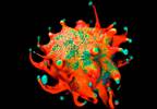 Primary End Point Not Met in Trial Testing Nivolumab Monotherapy for DLBCL Primary End Point Not Met in Trial Testing Nivolumab Monotherapy for DLBCL