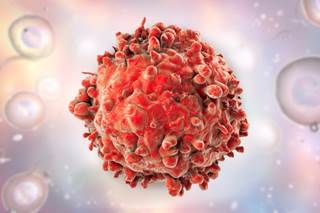 Findings from previous studies suggests that multiparameter flow cytometric minimal residual disease may be used to predict outcomes in acute myeloid leukemia. Findings from previous studies suggests that multiparameter flow cytometric minimal residual disease may be used to predict outcomes in acute myeloid leukemia.