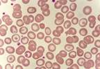 Ibrutinib Plus Nivolumab in 4 Cohorts of Patients With R/R NHL or CLL Ibrutinib Plus Nivolumab in 4 Cohorts of Patients With R/R NHL or CLL