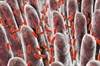 Pancreatic Cancer and the Microbiome — In the Clinic Pancreatic Cancer and the Microbiome — In the Clinic