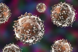 Early trial results show that immunotherapy using chimeric antigen receptor (CAR) T-cell therapy may be effective in patients with multiple myeloma. Early trial results show that immunotherapy using chimeric antigen receptor (CAR) T-cell therapy may be effective in patients with multiple myeloma.