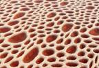 Daratumumab and Elotuzumab: Potential mAb Therapies for Multiple Myeloma Daratumumab and Elotuzumab: Potential mAb Therapies for Multiple Myeloma