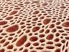 Daratumumab and Elotuzumab: Potential mAb Therapies for Multiple Myeloma Daratumumab and Elotuzumab: Potential mAb Therapies for Multiple Myeloma