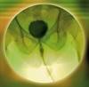 Adding Gemcitabine at the Time of Resection Reduces Recurrence, Cost in Early-Stage Bladder Cancer Adding Gemcitabine at the Time of Resection Reduces Recurrence, Cost in Early-Stage Bladder Cancer