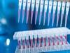 Next-Generation Sequencing Adds Value by Detecting More Mutations Than Polymerase Chain Reaction in Melanoma Next-Generation Sequencing Adds Value by Detecting More Mutations Than Polymerase Chain Reaction in Melanoma
