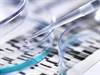 Gene Variant May Affect Response to Abiraterone in Certain Men with Prostate Cancer Gene Variant May Affect Response to Abiraterone in Certain Men with Prostate Cancer