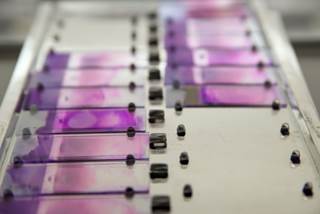 Perspectives differ on whether ponatinib is a niche drug that should be reserved for younger patients. Perspectives differ on whether ponatinib is a niche drug that should be reserved for younger patients.