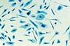 IL-23 Drives Castration-Resistant Prostate Cancer IL-23 Drives Castration-Resistant Prostate Cancer