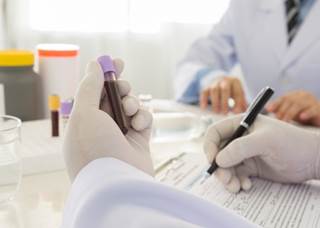 AMG 420 is an anti-B cell maturation antigen bispecific T cell engager antibody construct. AMG 420 is an anti-B cell maturation antigen bispecific T cell engager antibody construct.