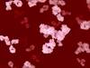 Bispecific Antibodies in Cancer Bispecific Antibodies in Cancer