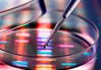 Genetic Counseling Recommended for Advanced Prostate Cancer Genetic Counseling Recommended for Advanced Prostate Cancer