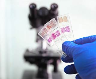 This fact sheet informs patients about what to expect prior to, during, and after a tissue biopsy. This fact sheet informs patients about what to expect prior to, during, and after a tissue biopsy.
