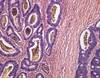 Bowel Preparation for Colorectal Cancer Screening: Improving Outcomes Bowel Preparation for Colorectal Cancer Screening: Improving Outcomes