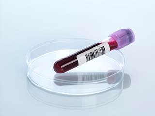 The Leukemia & Lymphoma Society partnered with Sutro Biopharma to test the safety of the investigational CD74-targeting antibody-drug conjugate STRO-001 for 2 blood cancers. The Leukemia & Lymphoma Society partnered with Sutro Biopharma to test the safety of the investigational CD74-targeting antibody-drug conjugate STRO-001 for 2 blood cancers.