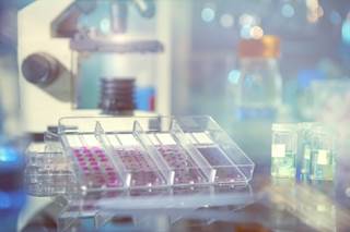 High-risk early breast cancer patients with circulating tumor cells 2 years after chemotherapy had greater risk of recurrence. Possible interventions are needed. High-risk early breast cancer patients with circulating tumor cells 2 years after chemotherapy had greater risk of recurrence. Possible interventions are needed.