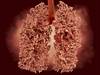 New Software Platform Helps Lung Cancer Screening New Software Platform Helps Lung Cancer Screening