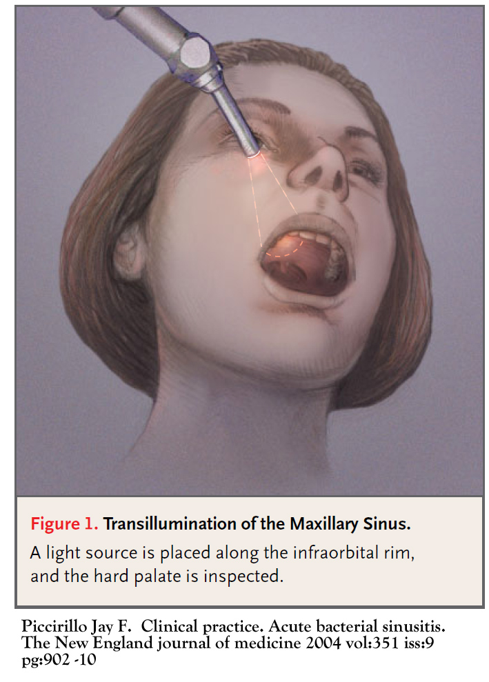 sinusitis-cancer-therapy-advisor